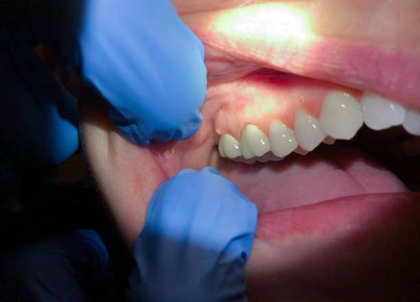 Best Emergency Dentist for Knocked-Out Tooth in Silver Lake, NJ